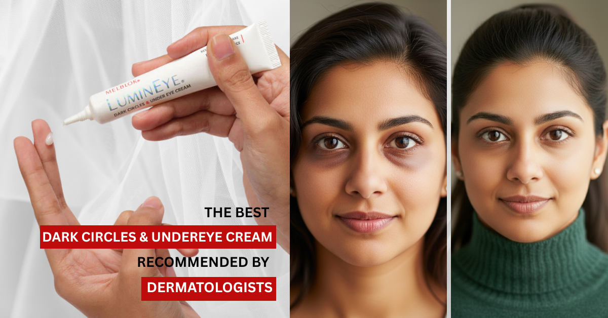 Rashmi’s Real Results | Melblok LuminEye Before & After