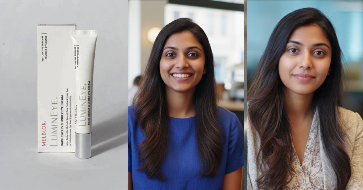 Aanya’s Melblok LuminEye Results | Dark Circles Faded Naturally